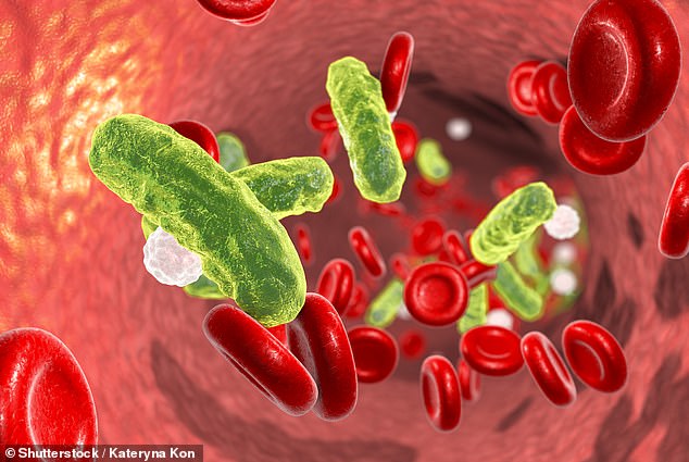 Bacterial infection is one of the most common causes of sepsis. Blood tests can detect an increase in white blood cells, which indicates the presence of infection