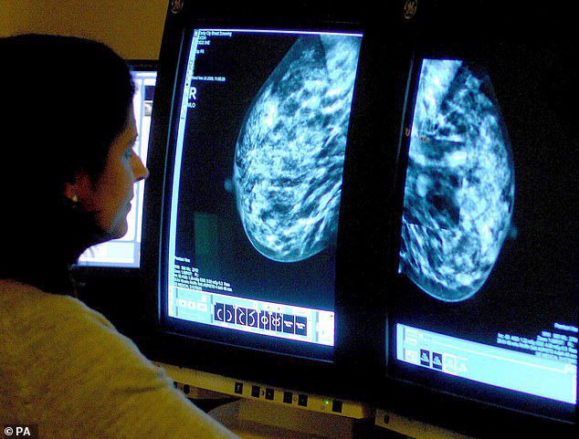 ‘This could help millions of women’: Rishi Sunak hails first-of-its-kind AI breast cancer screening trial set to be rolled out on the NHS in bid to catch lumps earlier than ever
