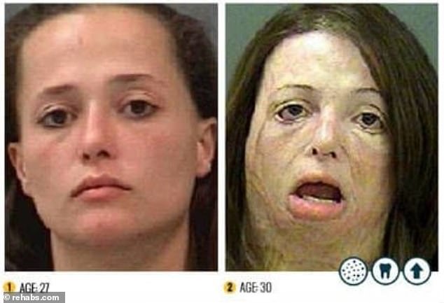 These photos taken three years apart show how meth use has changed this woman's appearance in a short time
