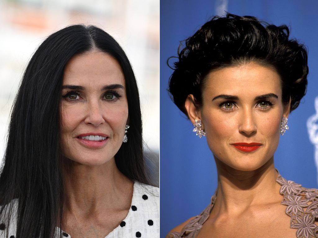 Demi Moore may have undergone cosmetic procedures to get her glowing skin at 61