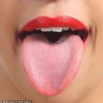 After viral TikTok claims ‘cracks’ on the tongue means you shouldn’t drink coffee, we reveal the medical problems you can see by looking into the mouth