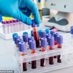 Doctors hail blood test that predicts if breast cancer will come back years before it shows up on scans