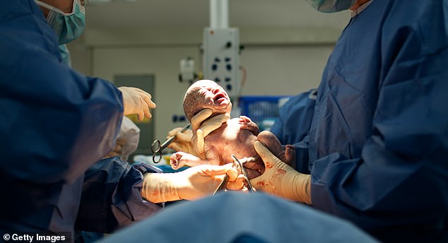 I survived a C-section with no anesthetic – it was agony and I felt the surgeon cut through layers of my muscle