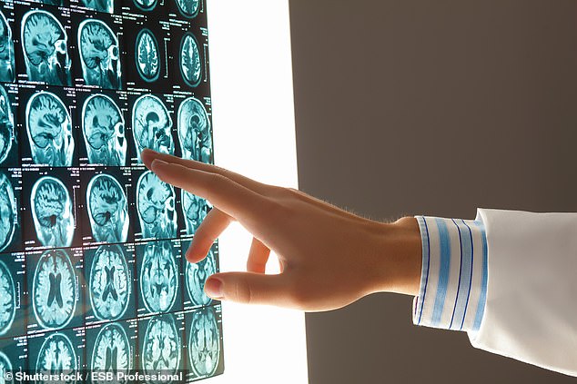 Scientists develop test that could detect dementia nine years before the disease strikes