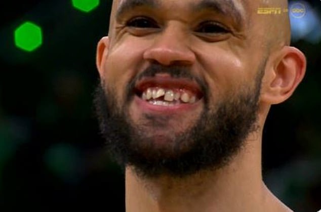 Derrick White chips tooth but luckily avoids major injury as his face smacks into the court floor – before Boston Celtics become NBA champions!