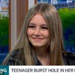 ‘I’ve been to hell and back’: Teen who burned hole in her lung after vaping equivalent to 400 cigarettes a week issues stark warning