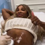 Serena Williams gets ‘confidence boosting’ skin-tightening treatment on her tummy – less than a year after welcoming second daughter: ‘I will always love my birthing scars’