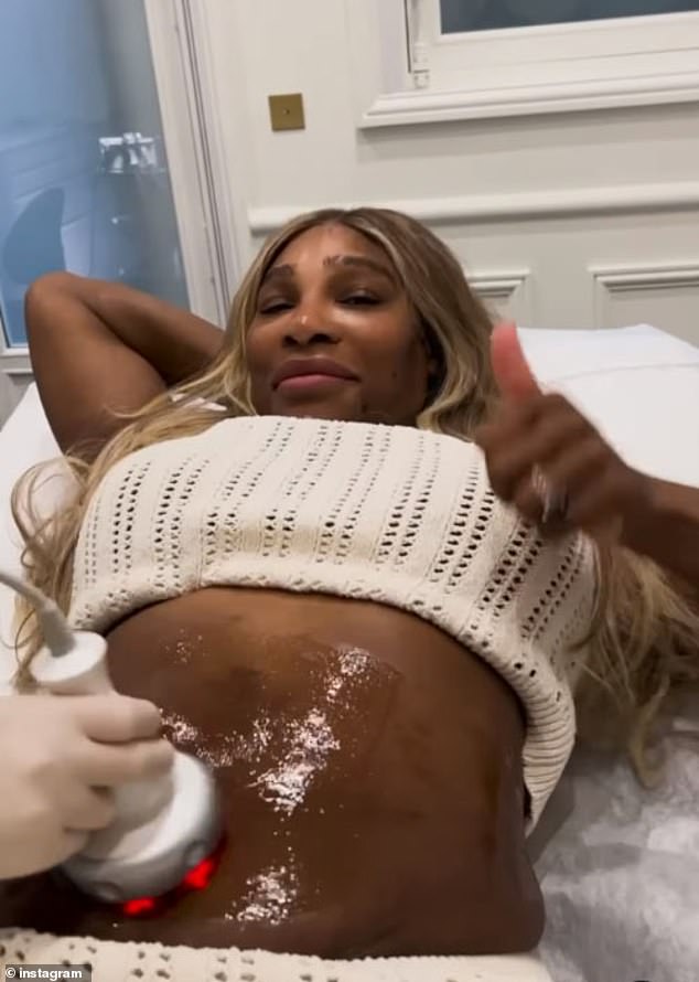 Serena Williams gets ‘confidence boosting’ skin-tightening treatment on her tummy – less than a year after welcoming second daughter: ‘I will always love my birthing scars’