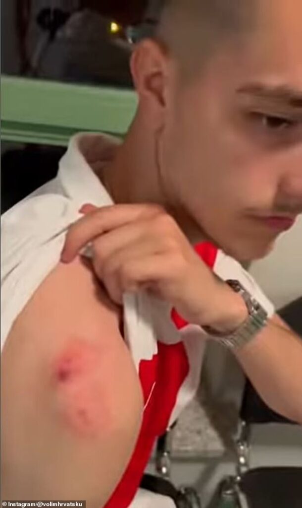 Croatia fan is ‘BITTEN by another supporter’ during a melee for a player’s shirt after Italy draw – with German police investigating