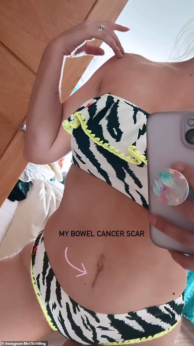 The 52-year-old Married At First Sight relationship expert showed off the tiny scar located below her navel in a series of bikini snaps while holidaying in Northern Ireland with her husband Gareth Brisbane.