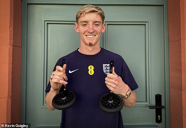 Grinning England star Anthony Gordon accepts cycling survival kit gift from Mail Sport after bike ride crash threw him 10 foot in the air and left him with cuts at the Euros