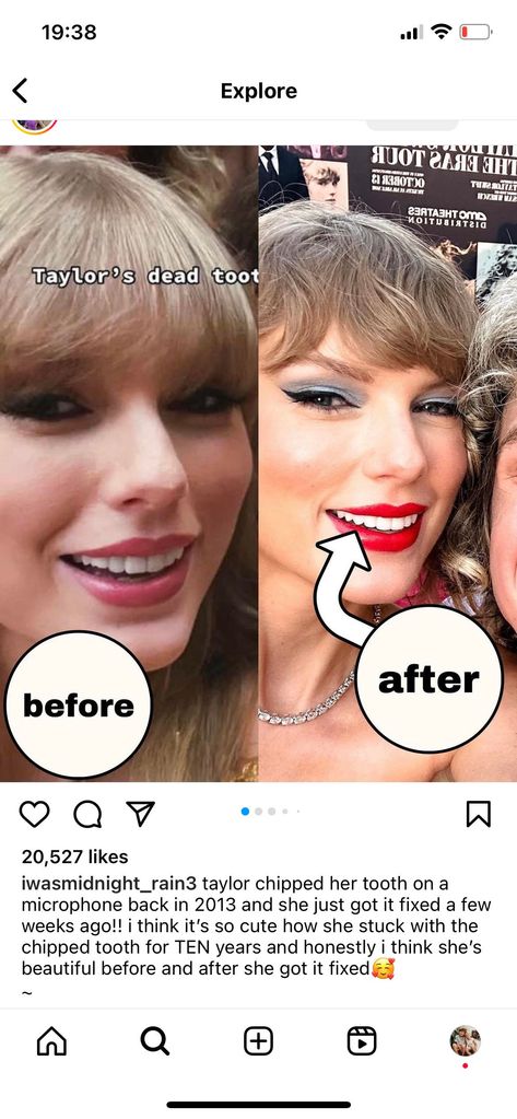 A fan posted before and after photos of Taylor's teeth