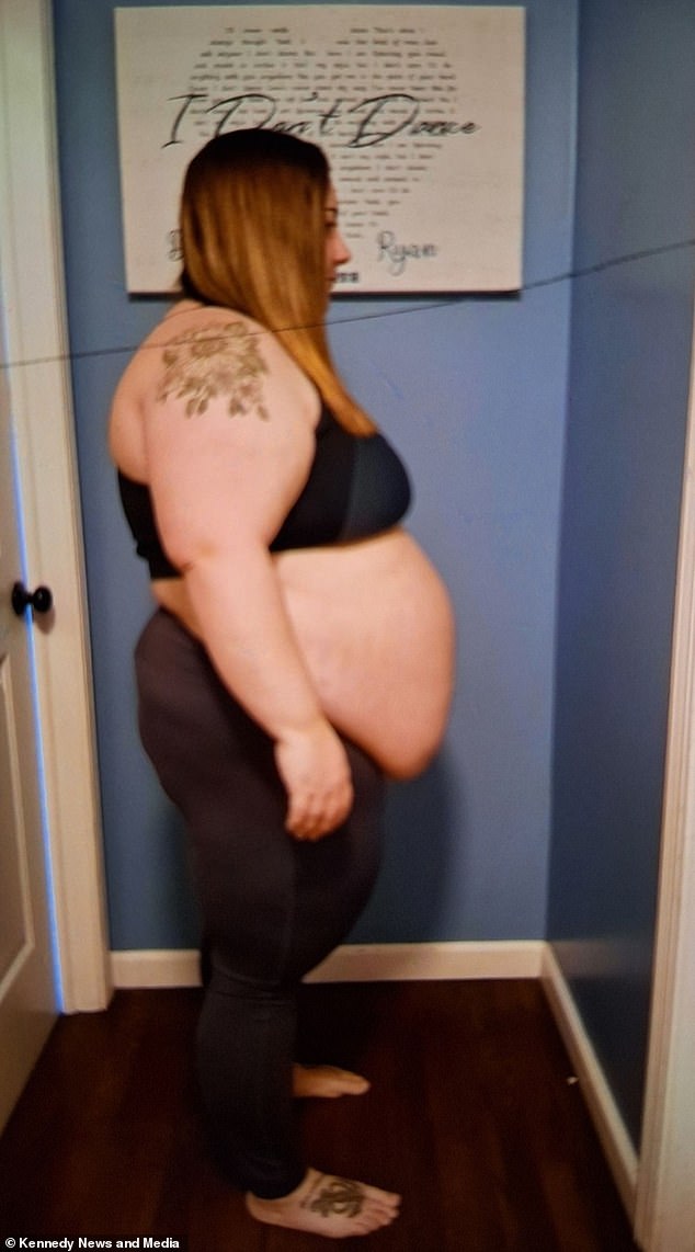 The pediatrician used weight loss injections for the first six months, then relied solely on diet and exercise for the next year until she lost an incredible 200 pounds