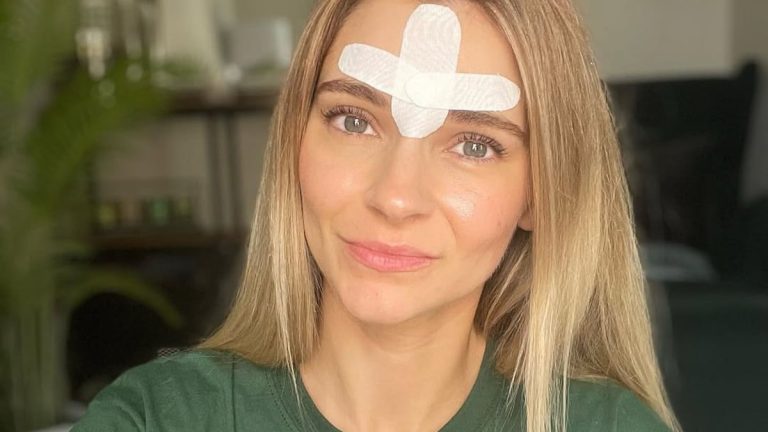 Do adhesive facial strips work to reduce wrinkles while sleeping?